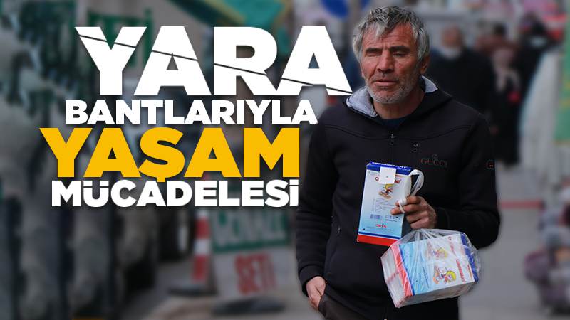 Yara bantlarıyla yaşam mücadelesi 