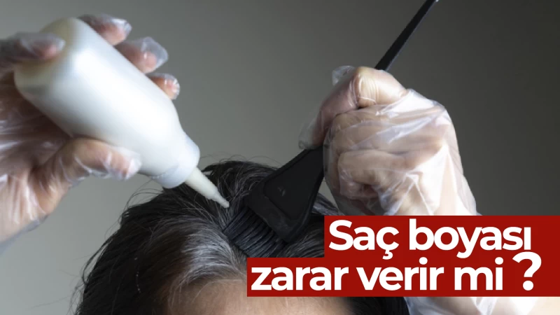 Saç boyası zarar verir mi? 