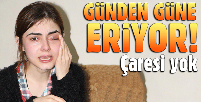 Her geçen gün eriyor