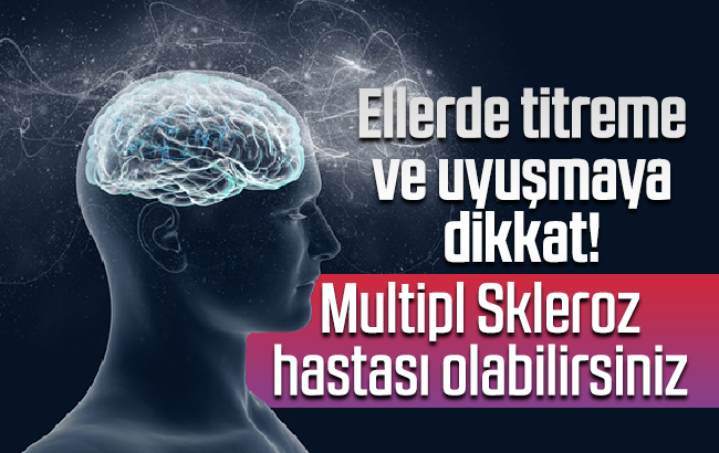 Multipl Skleroz dünyada 1 milyondan fazla kişide görülüyor