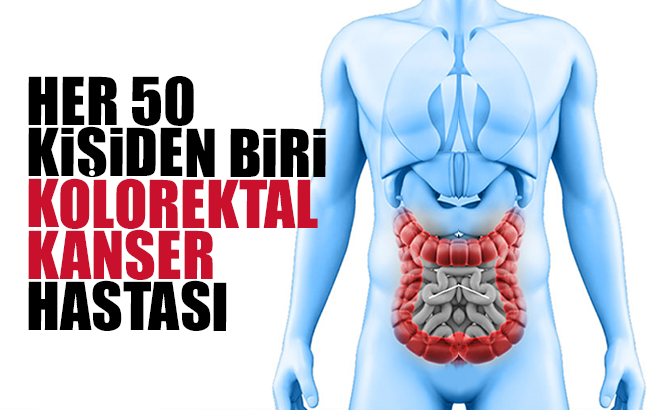 Ağırtaş; “Her 50 kişiden biri kolorektal kanser hastası”